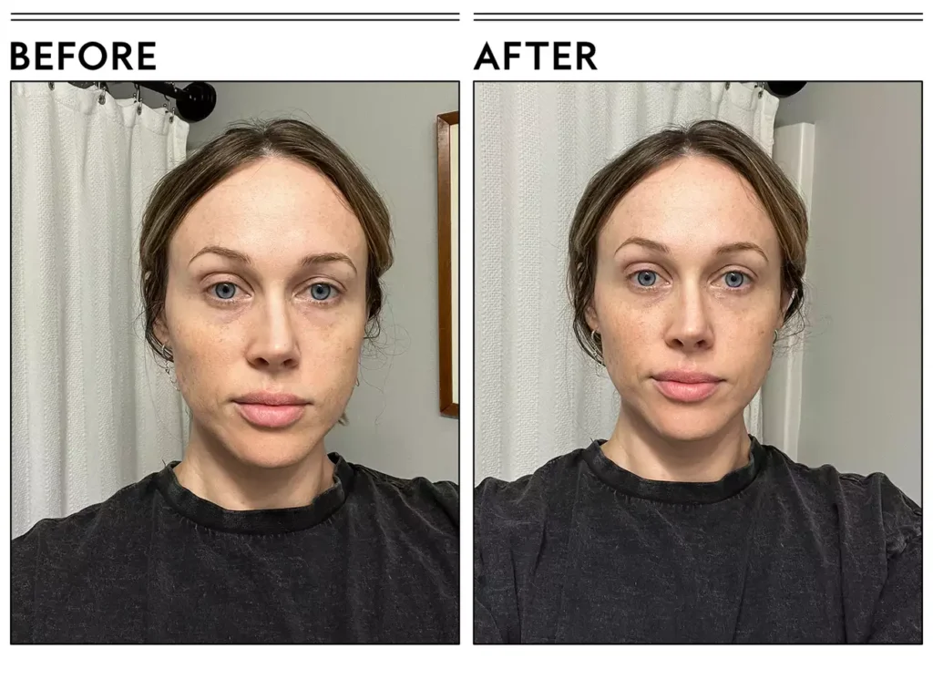 Applying eye cream using ring finger to under-eye area