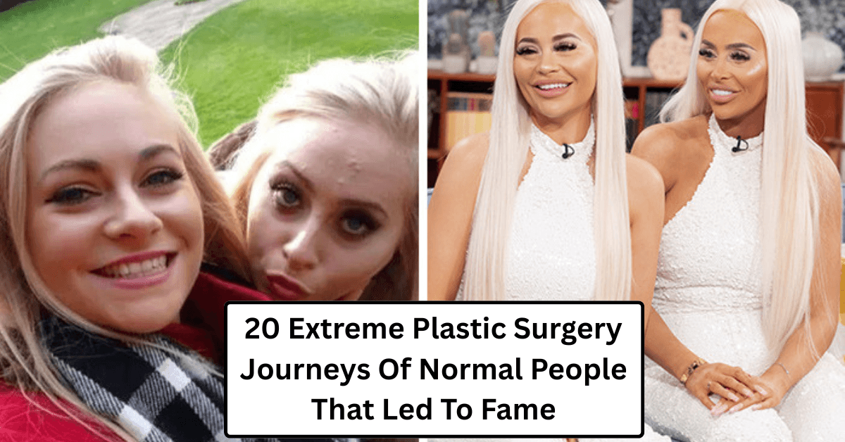 20 Extreme Plastic Surgery Journeys Of Normal People That Led To Fame