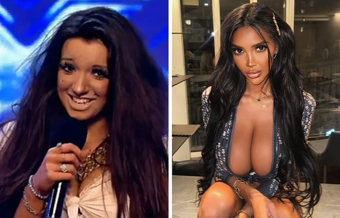 British influencer Chloe Khan with full lips, long dark hair, and glamorous makeup after multiple cosmetic enhancements.