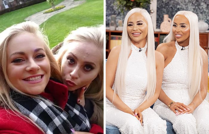 British twin sisters Daisy and Dolly Simpson smiling together, both styled as real-life Barbie dolls.