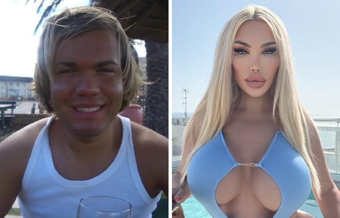 Jessica Alves posing in glamorous attire after multiple gender-affirming and cosmetic surgeries transforming her look.