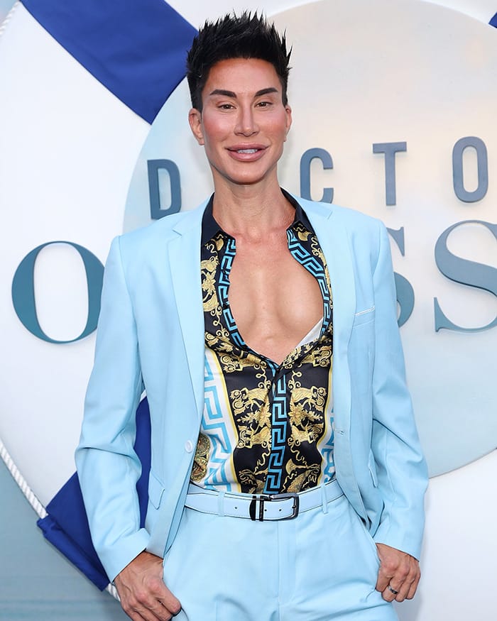 Justin Jedlica, known as the Human Ken Doll, showing his sculpted face and body after over 150 cosmetic surgeries.