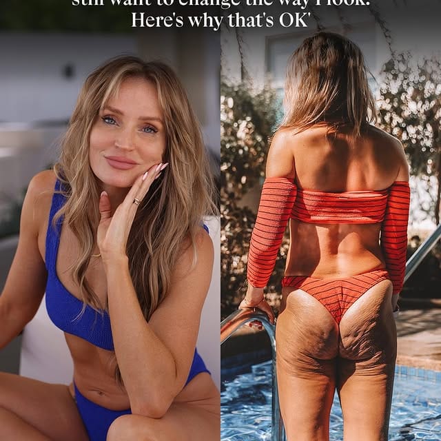 “Danae Mercer confidently shows her natural body, including visible cellulite, as part of her campaign for real, unfiltered images.”