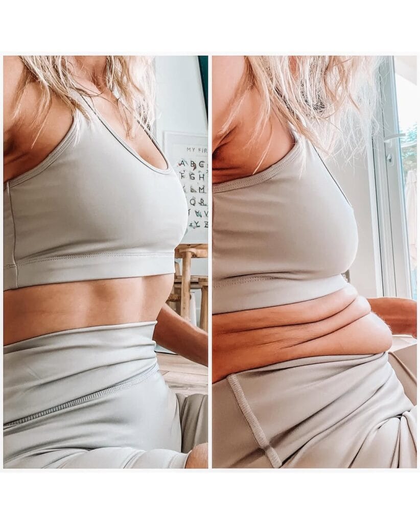 “Unedited close-up image of Danae Mercer’s thighs showing natural cellulite, paired with a caption promoting body acceptance.”